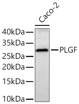 PLGF Rabbit Monoclonal Antibody