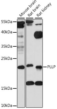 PLLP Rabbit Polyclonal Antibody