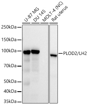 PLOD2/LH2 Rabbit Monoclonal Antibody