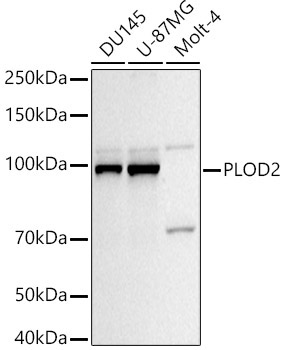 PLOD2/LH2 Rabbit Polyclonal Antibody