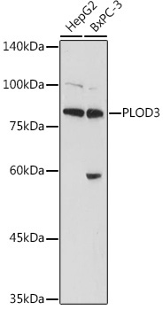 PLOD3 Rabbit Polyclonal Antibody