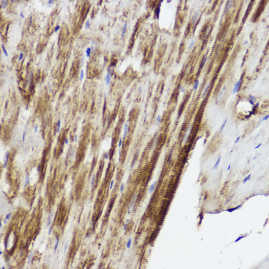 PLOD3 Rabbit Polyclonal Antibody - Image 2
