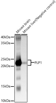 PLP1 Rabbit Polyclonal Antibody