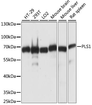 PLS1 Rabbit Polyclonal Antibody