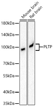 PLTP Rabbit Monoclonal Antibody