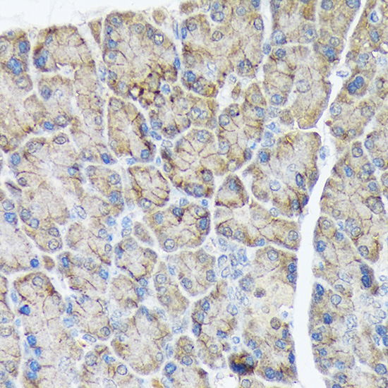 PLTP Rabbit Monoclonal Antibody - Image 2