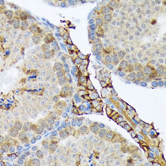 PLTP Rabbit Monoclonal Antibody - Image 3