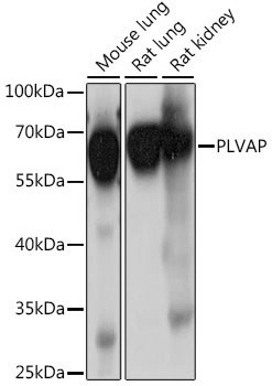 PLVAP Rabbit Polyclonal Antibody