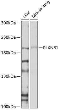 PLXNB1 Rabbit Polyclonal Antibody