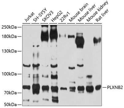 PLXNB2 Rabbit Polyclonal Antibody