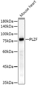 PLZF Rabbit Monoclonal Antibody - Image 2