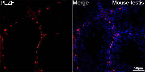 PLZF Rabbit Monoclonal Antibody - Image 3