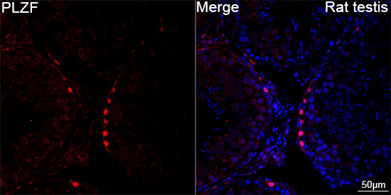 PLZF Rabbit Monoclonal Antibody - Image 4