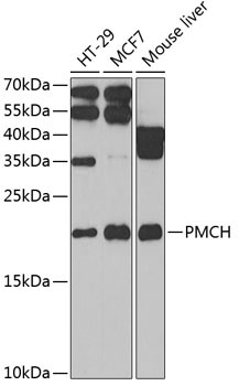PMCH Rabbit Polyclonal Antibody