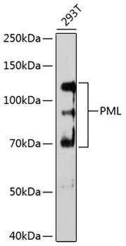 PML Rabbit Monoclonal Antibody