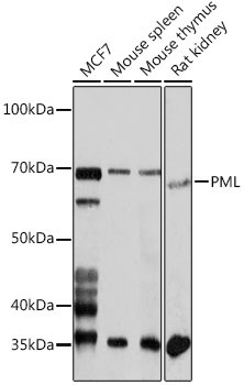 PML Rabbit Polyclonal Antibody