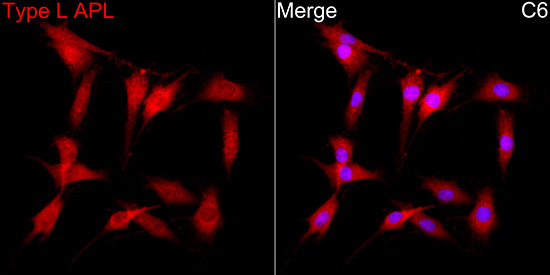 PML+RARA Rabbit Polyclonal Antibody