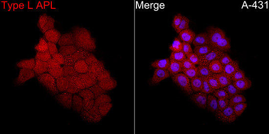 PML+RARA Rabbit Polyclonal Antibody - Image 2