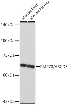 PMP70/ABCD3 Rabbit Monoclonal Antibody