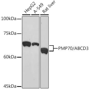 PMP70/ABCD3 Rabbit Monoclonal Antibody - Image 2