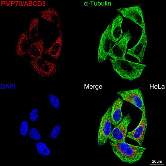 PMP70/ABCD3 Rabbit Monoclonal Antibody - Image 3