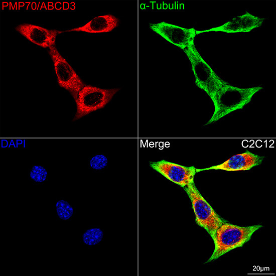 PMP70/ABCD3 Rabbit Monoclonal Antibody - Image 4