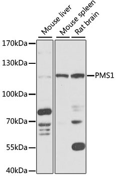 PMS1 Rabbit Polyclonal Antibody