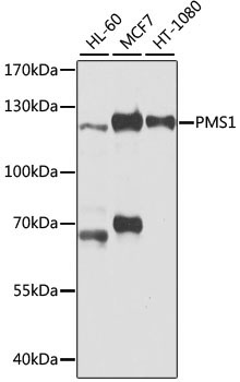 PMS1 Rabbit Polyclonal Antibody