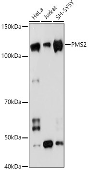 PMS2 Rabbit Monoclonal Antibody