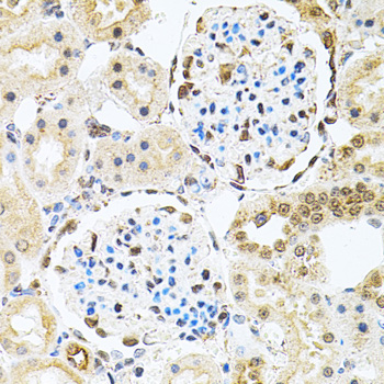 PNKP Rabbit Polyclonal Antibody - Image 2