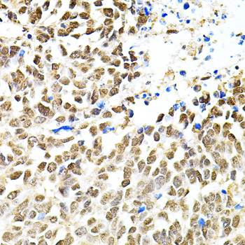 PNKP Rabbit Polyclonal Antibody - Image 3