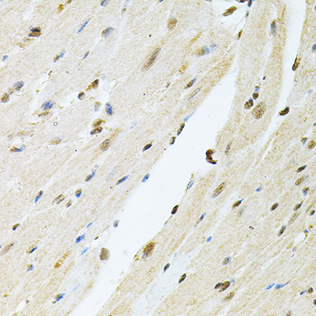 PNKP Rabbit Polyclonal Antibody - Image 4