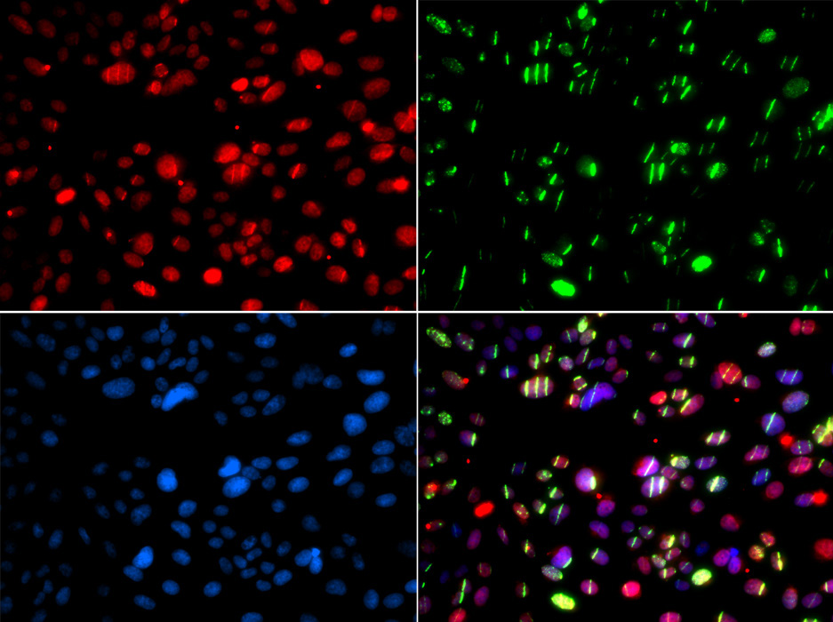 PNKP Rabbit Polyclonal Antibody - Image 5