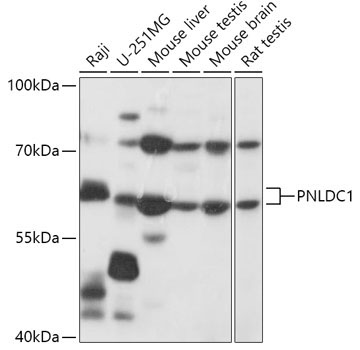 PNLDC1 Rabbit Polyclonal Antibody
