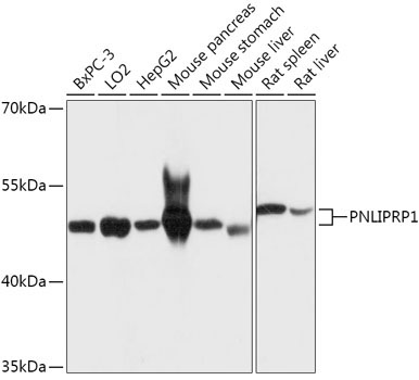 PNLIPRP1 Rabbit Polyclonal Antibody