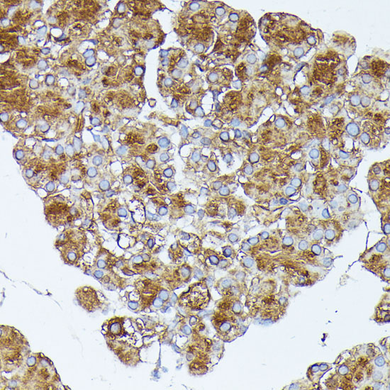 PNLIPRP1 Rabbit Polyclonal Antibody - Image 2