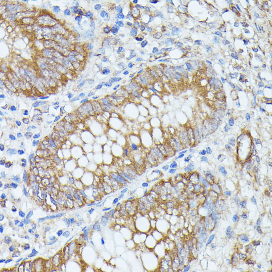 PNLIPRP1 Rabbit Polyclonal Antibody - Image 3
