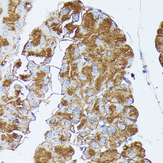 PNLIPRP1 Rabbit Polyclonal Antibody - Image 4
