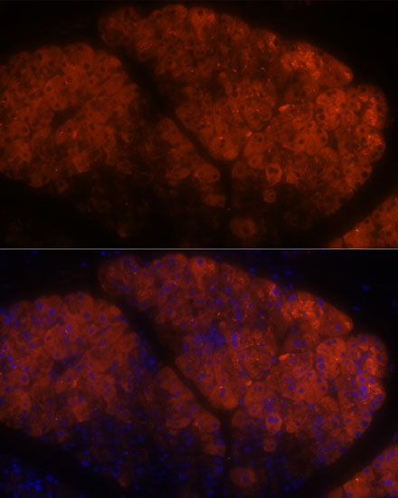 PNLIPRP1 Rabbit Polyclonal Antibody - Image 5