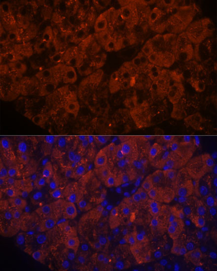 PNLIPRP1 Rabbit Polyclonal Antibody - Image 6