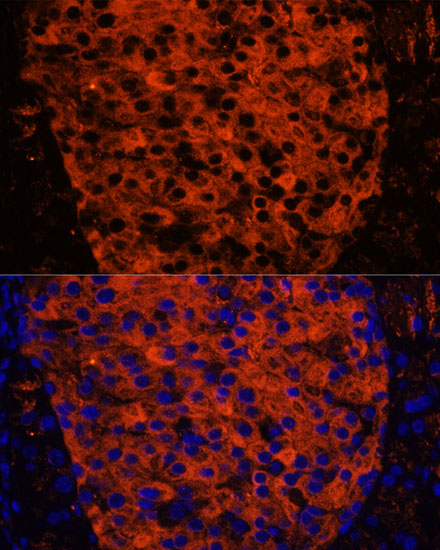 PNLIPRP1 Rabbit Polyclonal Antibody - Image 7