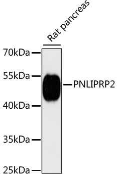 PNLIPRP2 Rabbit Polyclonal Antibody