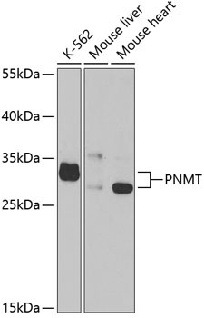 PNMT Rabbit Polyclonal Antibody