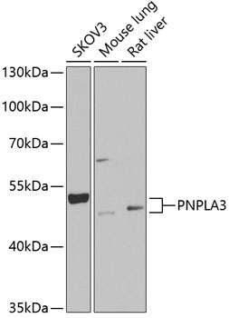 PNPLA3 Rabbit Polyclonal Antibody