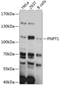 PNPT1 Rabbit Polyclonal Antibody