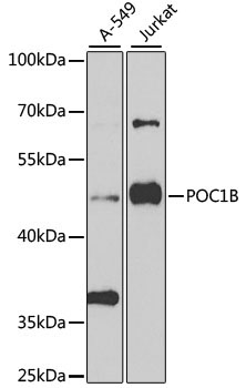 POC1B Rabbit Polyclonal Antibody