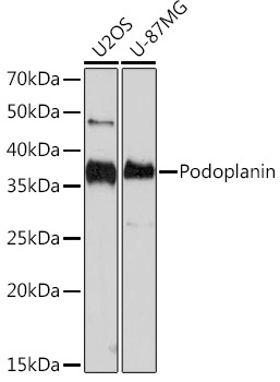 Podoplanin Rabbit Monoclonal Antibody - Image 2
