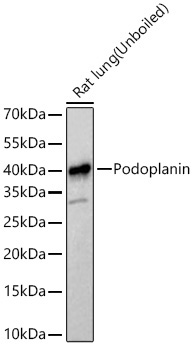 Podoplanin Rabbit Monoclonal Antibody - Image 3