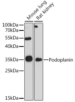 Podoplanin Rabbit Polyclonal Antibody