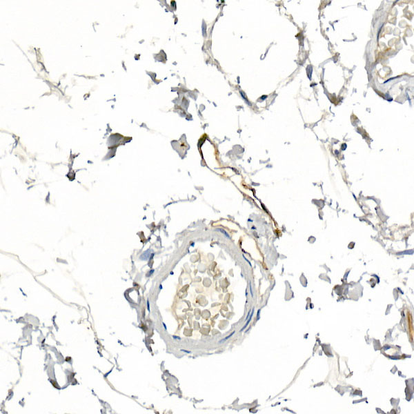 Podoplanin Rabbit Polyclonal Antibody - Image 2